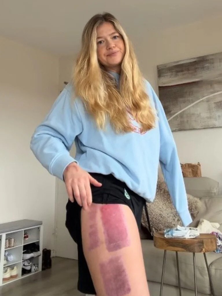 Sydney Shark Attack Survivor Faces New Health Crisis - Second Image