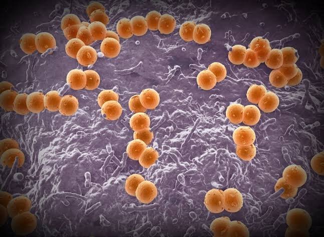 Meningococcal Outbreak Sparks Fear In Western Australia Amid Rising Cases - Second Image